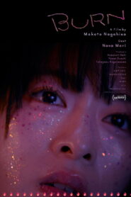 Burn